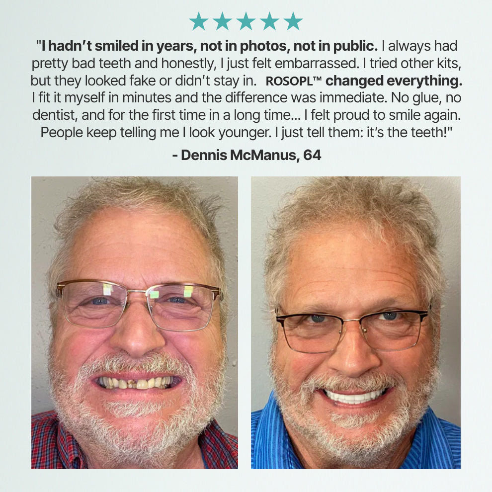 🌎Ends Today: 70% OFF!    Custom-Fit Full Functional DenturesMake you more confident✨