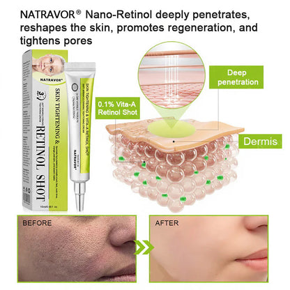 🧠👨‍⚕️Made and shipped from the USA 💫NATRAVOR® Botox & Vita-A Retinol Shot Wrinkle-Lift Tightening cream - Last Day Promotion 70% OFF