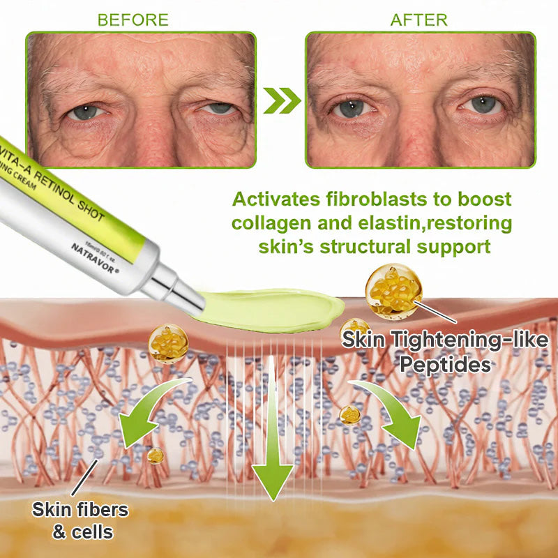 🧠👨‍⚕️Made and shipped from the USA 💫NATRAVOR® Botox & Vita-A Retinol Shot Wrinkle-Lift Tightening cream - Last Day Promotion 70% OFF