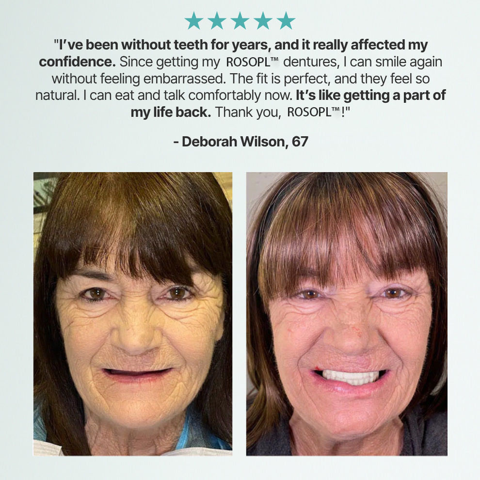 🌎Ends Today: 70% OFF!    Custom-Fit Full Functional DenturesMake you more confident✨